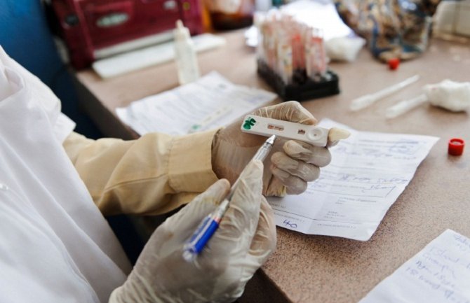 U Francuskoj razvijen 15-minutni test za otkrivanje ebole