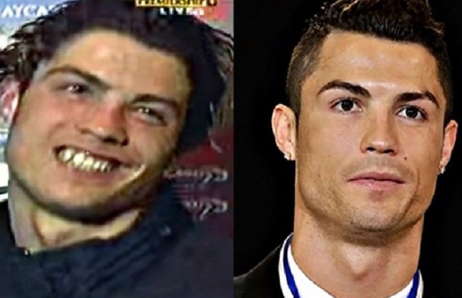 Ronaldo: Nekada ružno pače, sada prelijepi labud! (FOTO)(VIDEO) - 548c5ffb-6c1c-47f6-8298-1e425bfa64d2-ronaldo-preview
