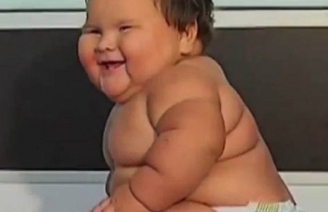 Upoznajte djevojčicu koja ima 10 mjeseci i 20 kilograma (VIDEO)