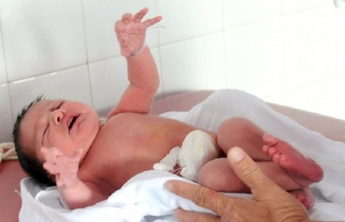 Simptome zavisnosti po rođenju  imale tri bebe