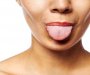 Boja jezika otkriva infekcije i nedostatak vitamina