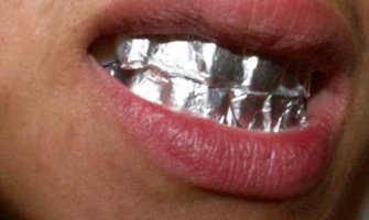 Recept koji je zaludio svijet: Izbijelite zube pomoću aluminijske folije