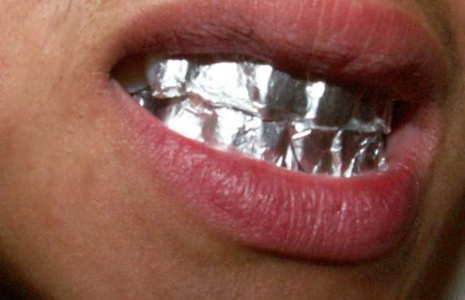 Recept koji je zaludio svijet: Izbijelite zube pomoću aluminijske folije