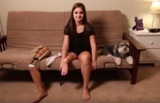 Ljekari djevojčici naopako zašili nogu zbog proteze (VIDEO)