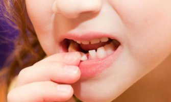 Evo zašto treba čuvati mliječne zube svoje djece!
