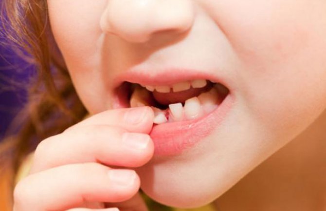 Evo zašto treba čuvati mliječne zube svoje djece!