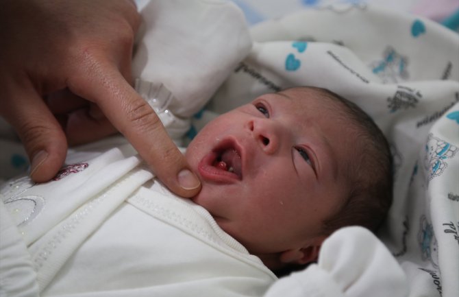 Nesvakidašnji slučaj: Dan nakon rođenja bebi izvađena dva zuba