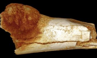 Otkriven RAK na fosilu starom 1,7 miliona godina