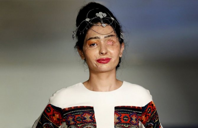 Žrtva napada kiselinom prošetala modnom pistom u Njujorku (FOTO)