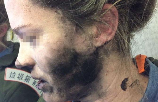 Incident u avionu: Putnici eksplodirale slušalice u ušima