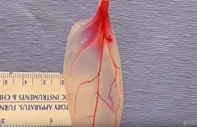 Pogledajte kako su naučnici list spanaća pretvorili u ljudsko srčano tkivo (VIDEO)