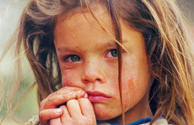 U Crnoj Gori živi više od 15.000 djece u siromaštvu