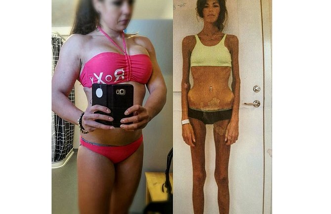 Imala je samo 30kg a onda je odlučila da se riješi svoje bolesti