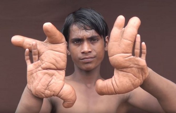 Zbog njegovih gigantskih ruku nazivaju ga ''ukletim demonom'' (VIDEO)