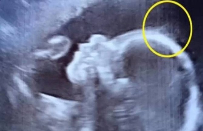 Trudnica došla na ultrazvuk pa zbunila ginekologa (VIDEO)