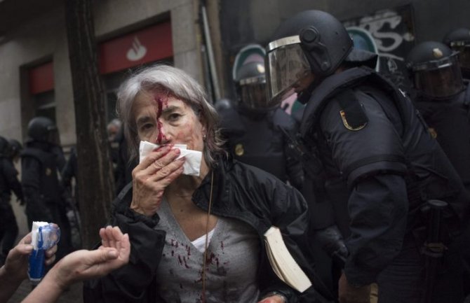 Krv na ulicama Katalonije, povrijeđeno preko 760 osoba, zatvorena birališta(FOTO)(VIDEO)