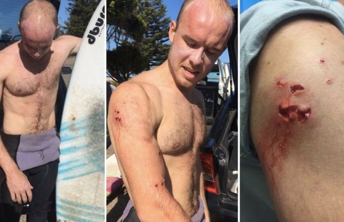 Australija: Doktor ajkulu udario pesnicom u nos i odbranio se