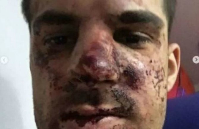 Fudbaler pretučen zbog parking mjesta, završio u bolnici
