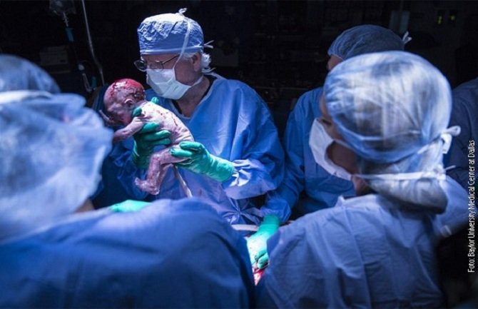 U SAD rođena prva beba iz presađene materice 