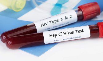 Na HIV i Hepatitis C testiralo se 40 osoba, sve veća stopa prenosa ovih infekcija 