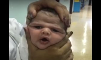 Medicinske sestre stiskale bebi glavu pa otpuštene(VIDEO)