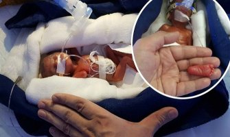 Beba rođena sa samo 400 grama izborila se za život