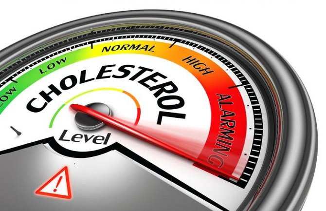 Ljekovi ili promjena ishrane: Kako smanjiti holesterol?