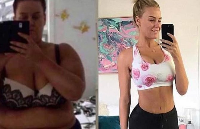 Promijenila život uz pomoć jedne operacije: Izgubila 92 kilograma za 11 mjeseci (FOTO)