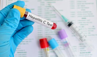 Virusne Hepatitis B i C infekcije u velikoj mjeri prisutne u CG, pojednostaviti procedure testiranja