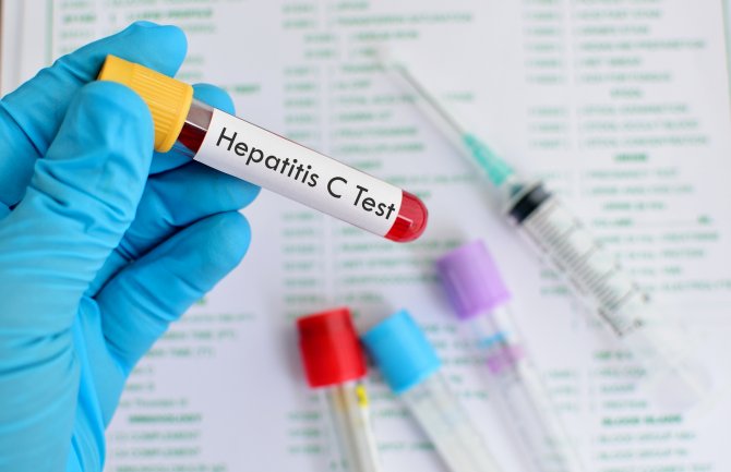 Virusne Hepatitis B i C infekcije u velikoj mjeri prisutne u CG, pojednostaviti procedure testiranja