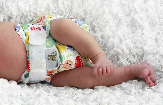 4-mjesečna beba umrla od pelenskog osipa, roditelji dvije nedjelje djetetu nijsu zamijenili pelenu