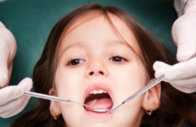 Švajcarska: Majka završila na sudu, jer je kćerki izvadila mliječne zube