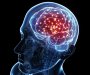 Muškarac mjesecima imao jake migrene: Larve u mozgu uzrokovale bolove