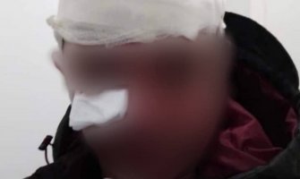 Uznemirujući snimci iz Nikšića, krvave glave, više povrijeđenih policajaca i navijača (VIDEO)
