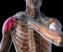 Bol u ramenu: Uzroci i posljedice po zdravlje 