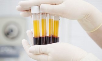 Počinje najveće probno testiranje krvi u svijetu na 50 tipova karcinoma