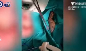 Muškarcu hirurški uklonili ribu iz debelog crijeva, tvrdio da je slučajno sjeo na nju (VIDEO)