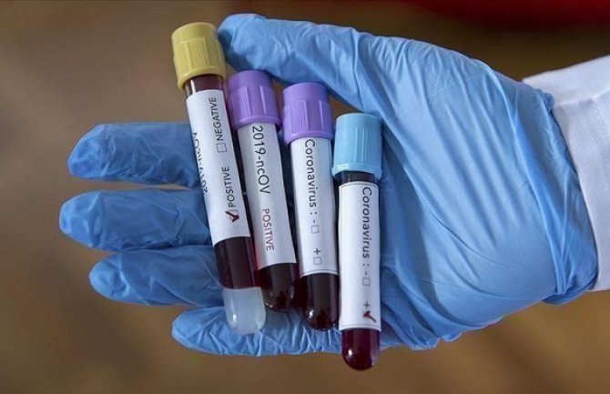 U Srbiji 309 novozaraženih koronavirusom, 11 osoba preminulo 
