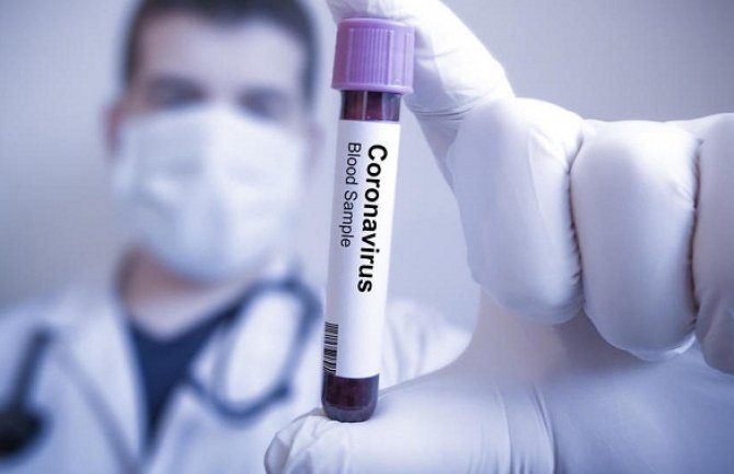 U Sloveniji potvrđeno najviše slučajeva koronavirusa od sredine aprila, 160 aktivnih slučajeva