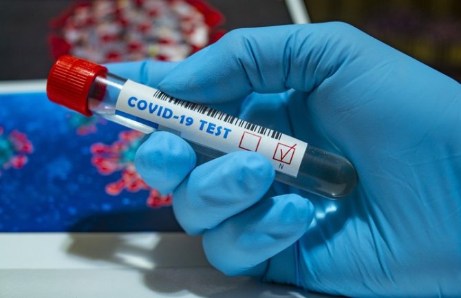  11 dokazanih simptoma koronavirusa koje ne bi trebalo da ignorišete 