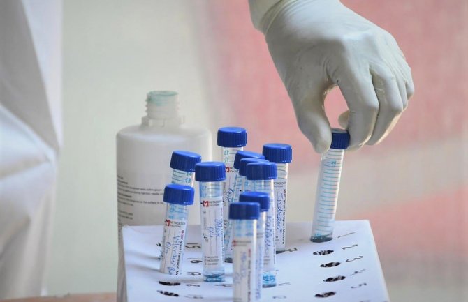 Tvorac ruske vakcine: Koronavirus će biti pod kontrolom, poput gripa