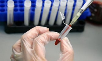 Jednostavnim testom krvi biće moguće utvrditi 13 različitih vrsta raka