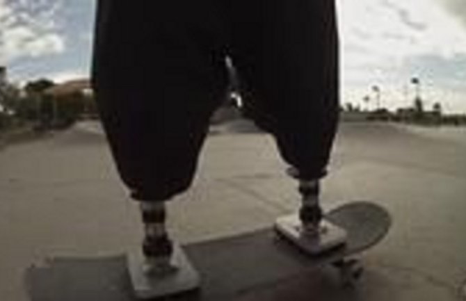 On nema obje noge, ali je naučio da vozi skejt! (VIDEO)