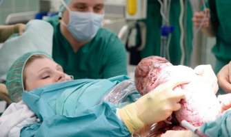 Nova metoda porođaja: Žena sama izvlači dijete iz svog stomaka