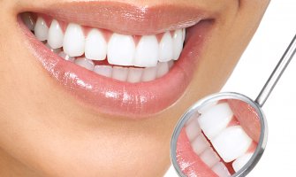 Pet razloga zbog kojih je bitno uklanjanje zubnog kamenca