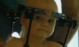 Hirurg uspio da poveže bebinu glavu nakon teške saobraćajne nesreće (VIDEO)