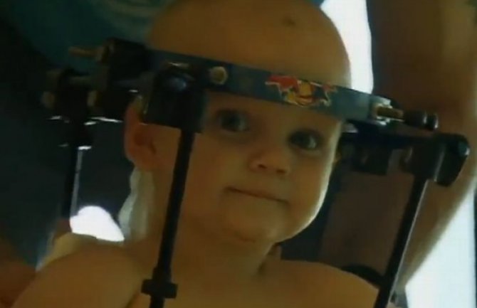 Hirurg uspio da poveže bebinu glavu nakon teške saobraćajne nesreće (VIDEO)