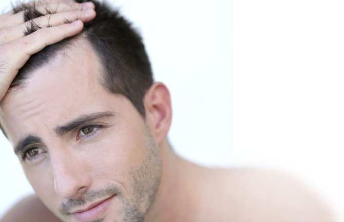 Evo kako da spriječite gubitak kose