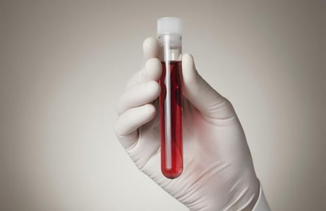 Testovi krvi će pokazivati da li su nam potrebni antibiotici