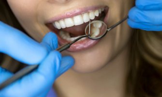 Namirnice koje štete i ugrožavaju zdravlje zuba